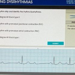 Basic dysrhythmia review for the nurse adventhealth