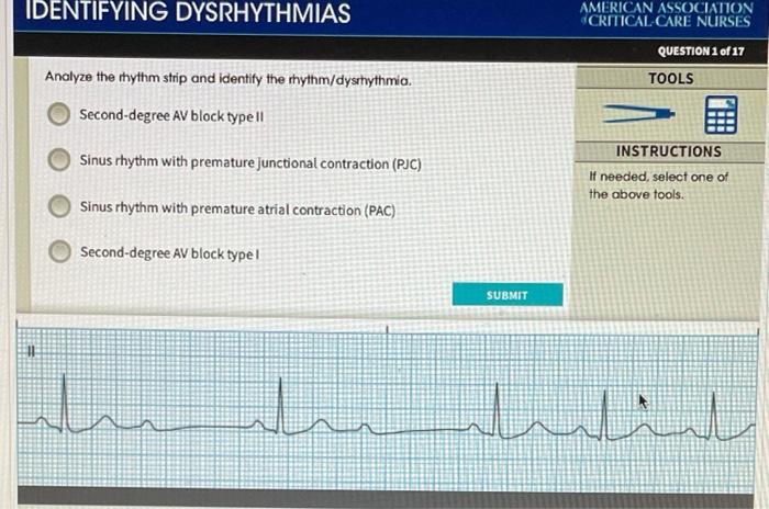 Basic dysrhythmia review for the nurse adventhealth